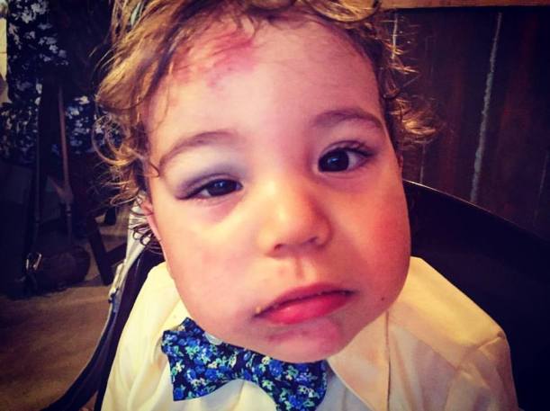 bow-tie-and-black-eye